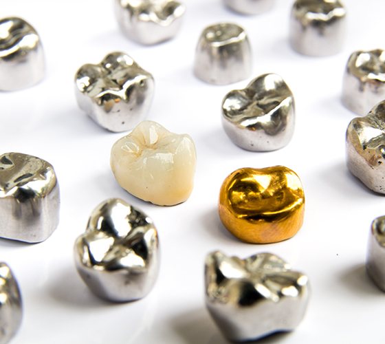 Different types of dental crowns
