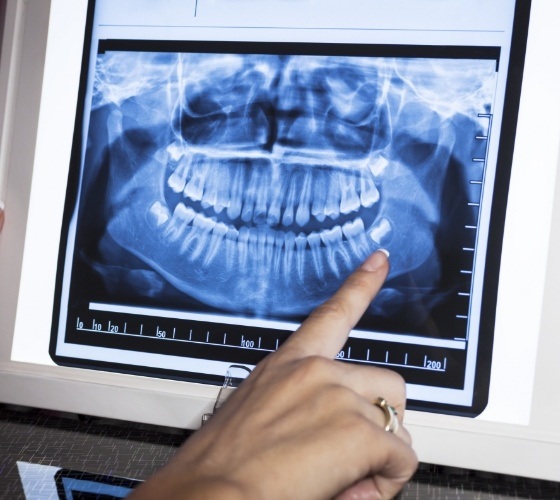 Pediatric dentist pointing to digital dental x rays in Northampton Amherst and Greenfield