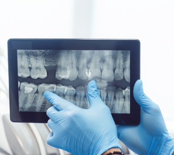 Gloved hand examining a digital dental x ray