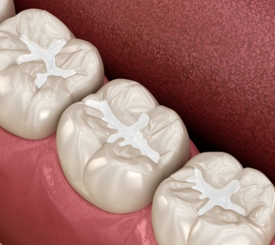 Animated row of teeth with dental sealants