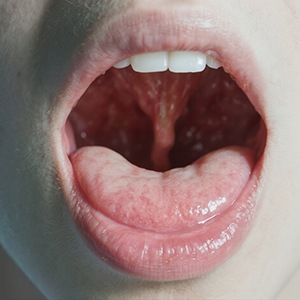 Up-close view of a mouth during an oral cancer screening in Western Massachusetts