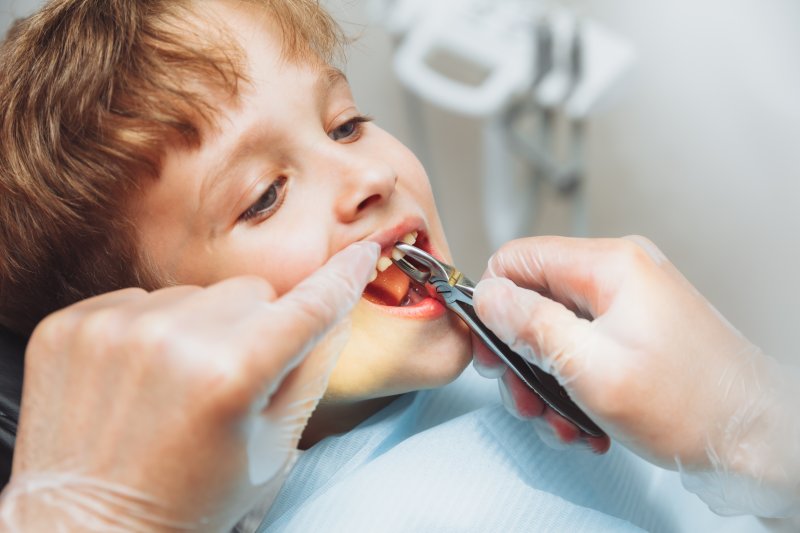 little boy having a baby tooth extracted